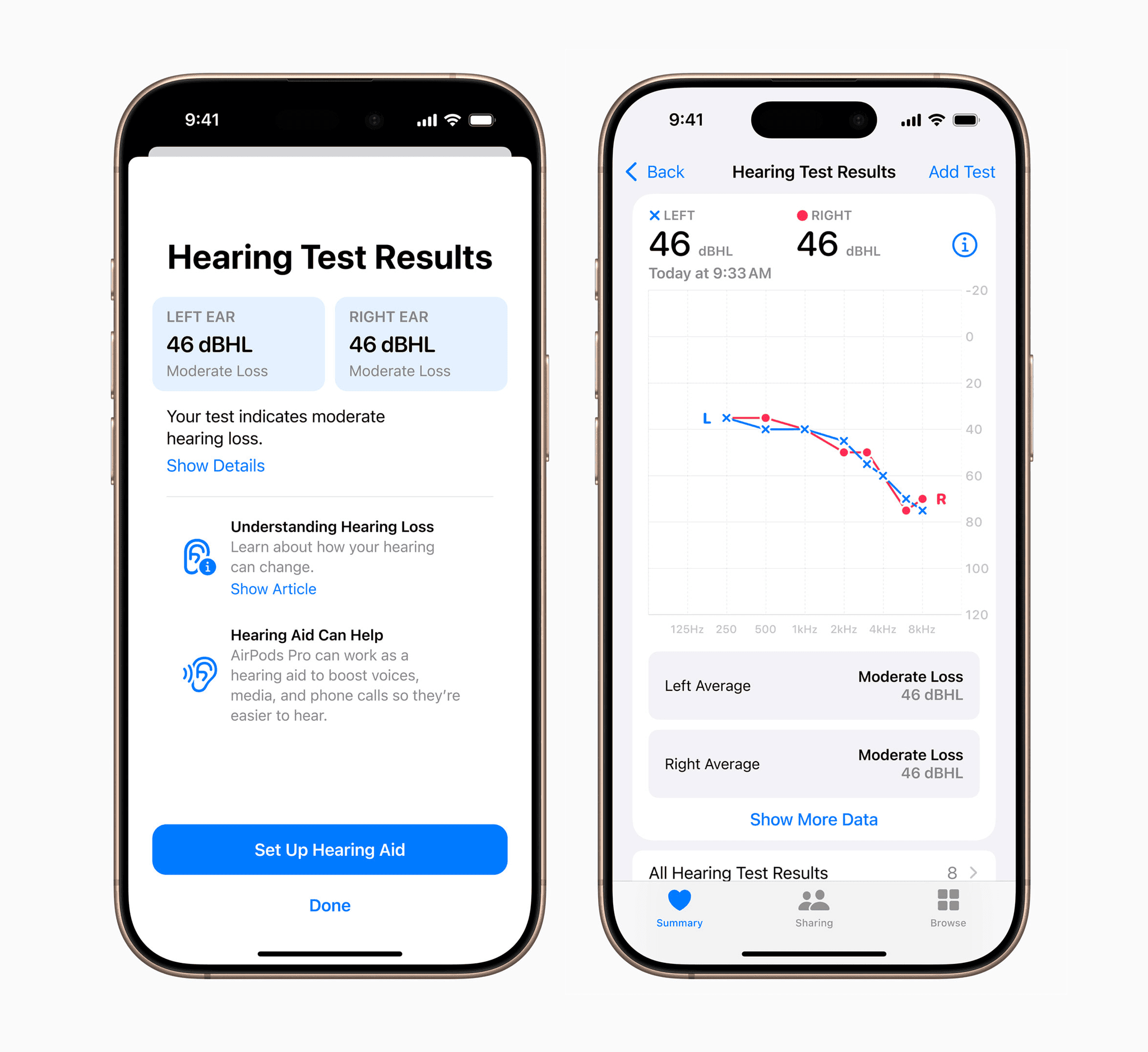 Hearing Test results in the Health app in iOS 18.1. Source: Apple.